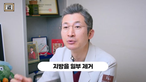Upper Eyelid Fat Removal: Solving the Problem of Puffy-Looking Eyes!! image 14