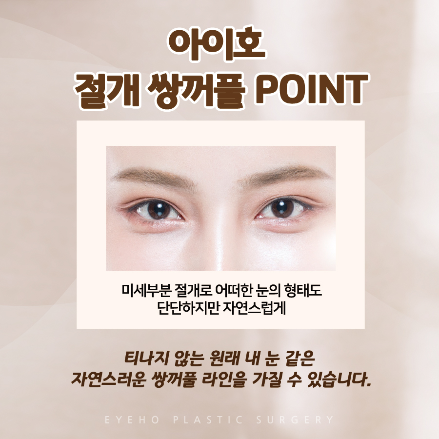 Natural Eye Line Before and After Double Eyelid Incision Surgery image 4
