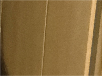 Comparing Incisional and Non-incisional Double Eyelid Surgery Before and After image 21