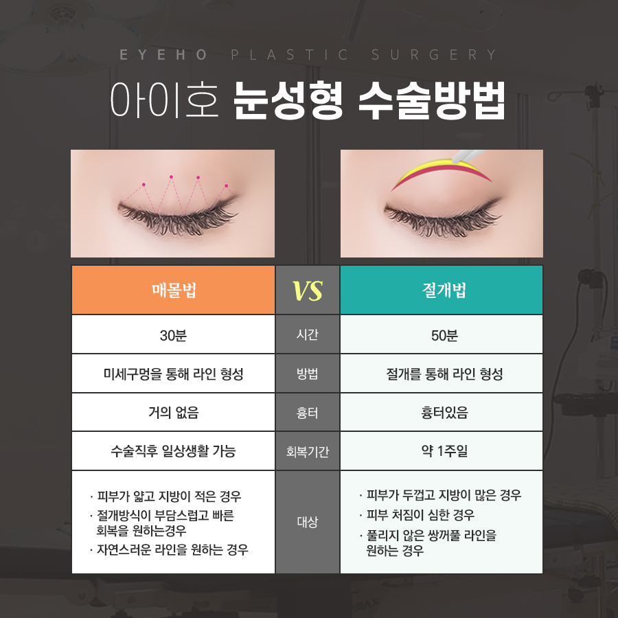 쌍꺼풀수술 가격 & 비절개 눈매교정 후기 (7일 경과) / 짝눈쌍수 관련 이미지 2