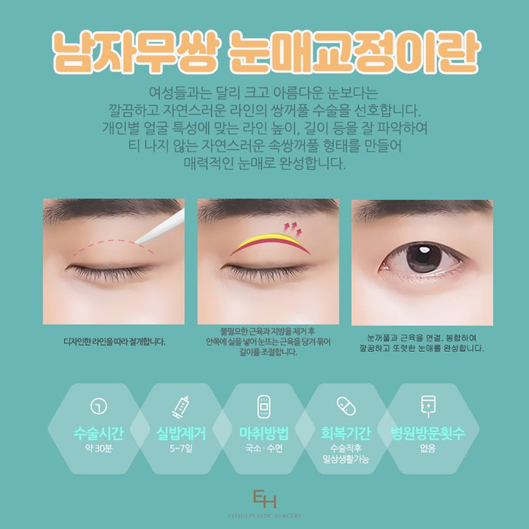 Natural and Harmonious Male Double-Eyelid Correction image 2