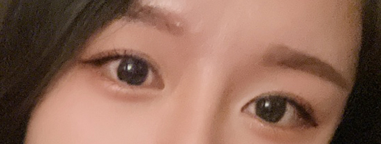 쌍꺼풀수술가격 이미지 변화를 바란다면 관련 이미지 19