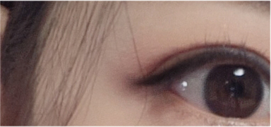 If You’re Considering Non-Incisional Eye Correction Surgery, Compare Reviews image 21