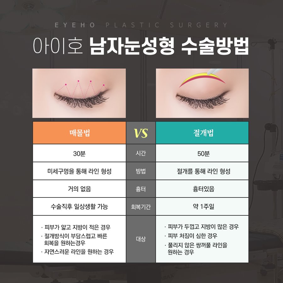 Male Eye Correction Surgery Should Be Tailored to the Individual Face image 4