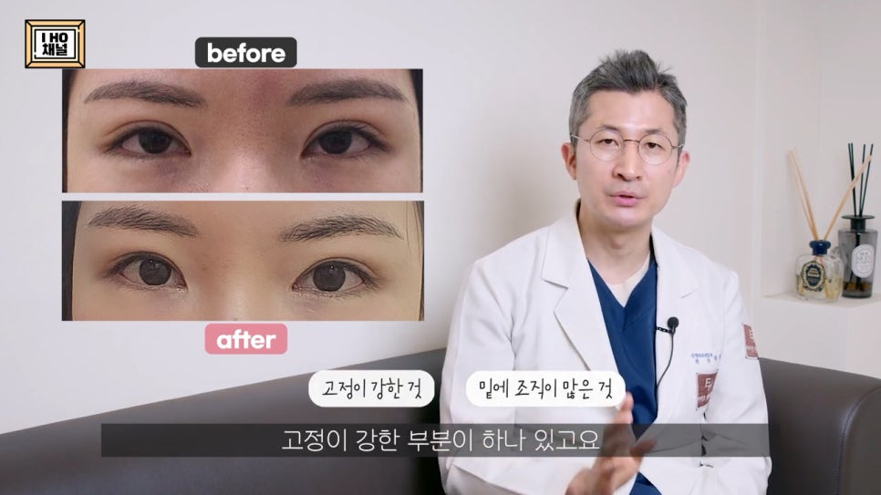 소세지눈 다 같은 게 아니다!? 유형별 재수술 방법에 대해 알려드리겠습니다. 관련 이미지 52