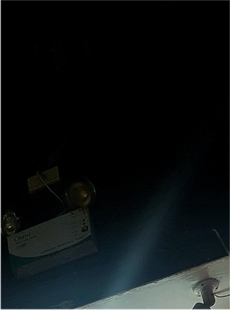 눈매교정 안검하수수술 비용 그리고 무쌍눈매교정후기 N일차 관련 이미지 19