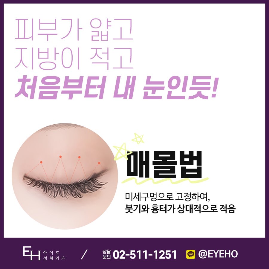 쌍꺼풀 수술 매몰 및 쌍꺼풀수술후기 / 쌍꺼풀 수술 병원 비교 관련 이미지 2