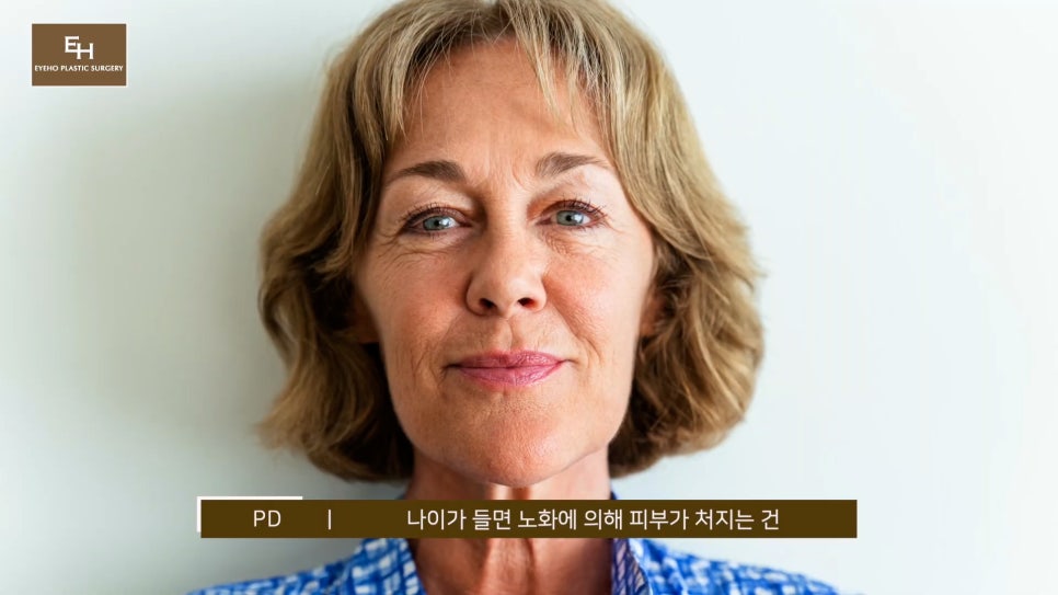 처진눈 상안검? 눈썹하거상술? 궁금하시다면 들어와!! 관련 이미지 1
