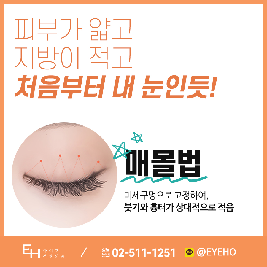 쌍꺼풀수술비용 결과는 중요하니까 비교 분석 관련 이미지 2