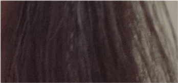 If You’re Considering Non-Incisional Eye Correction Surgery, Compare Reviews image 26