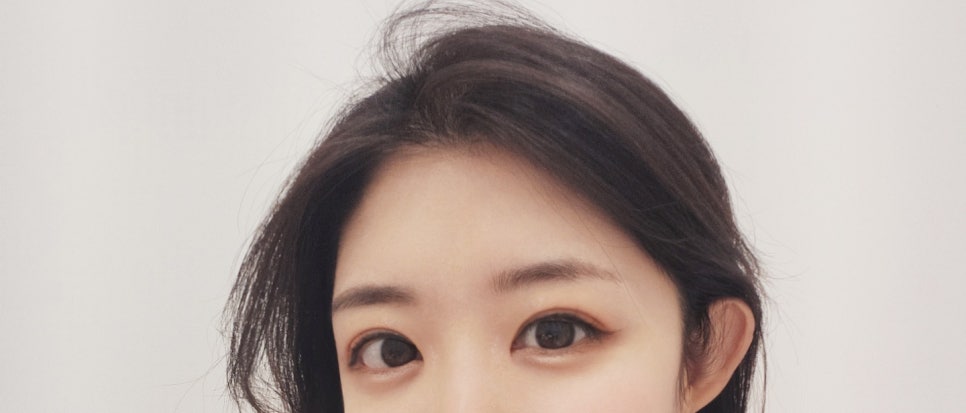 눈매교정 쌍수 : 무쌍 눈매교정 후기, 눈매교정 가격 비교 및 부작용 관련 이미지 15