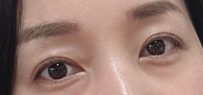 쌍꺼풀수술가격 분위기 변화를 원한다면 관련 이미지 28