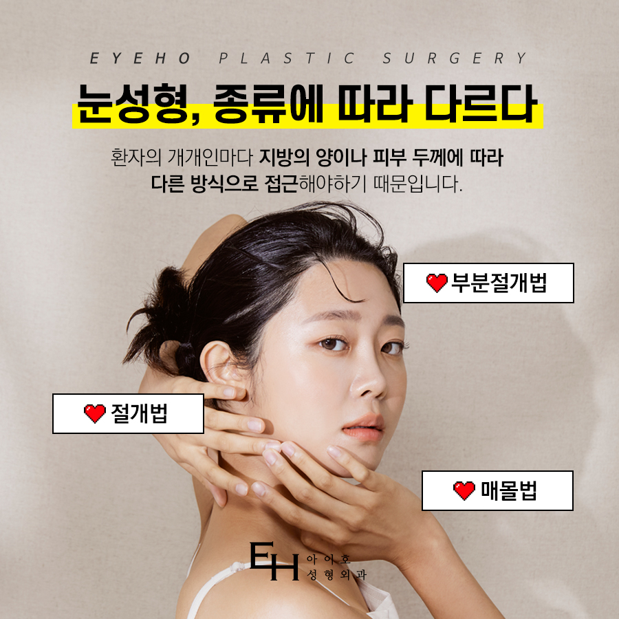 Comparing Incisional and Non-incisional Double Eyelid Surgery Before and After image 4