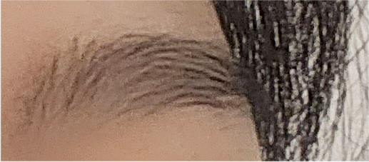 쌍수매몰법 매력적인 나만의 라인으로 관련 이미지 20