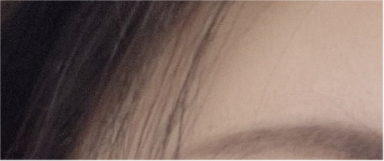 If You’re Considering Non-Incisional Eye Correction Surgery, Compare Reviews image 18
