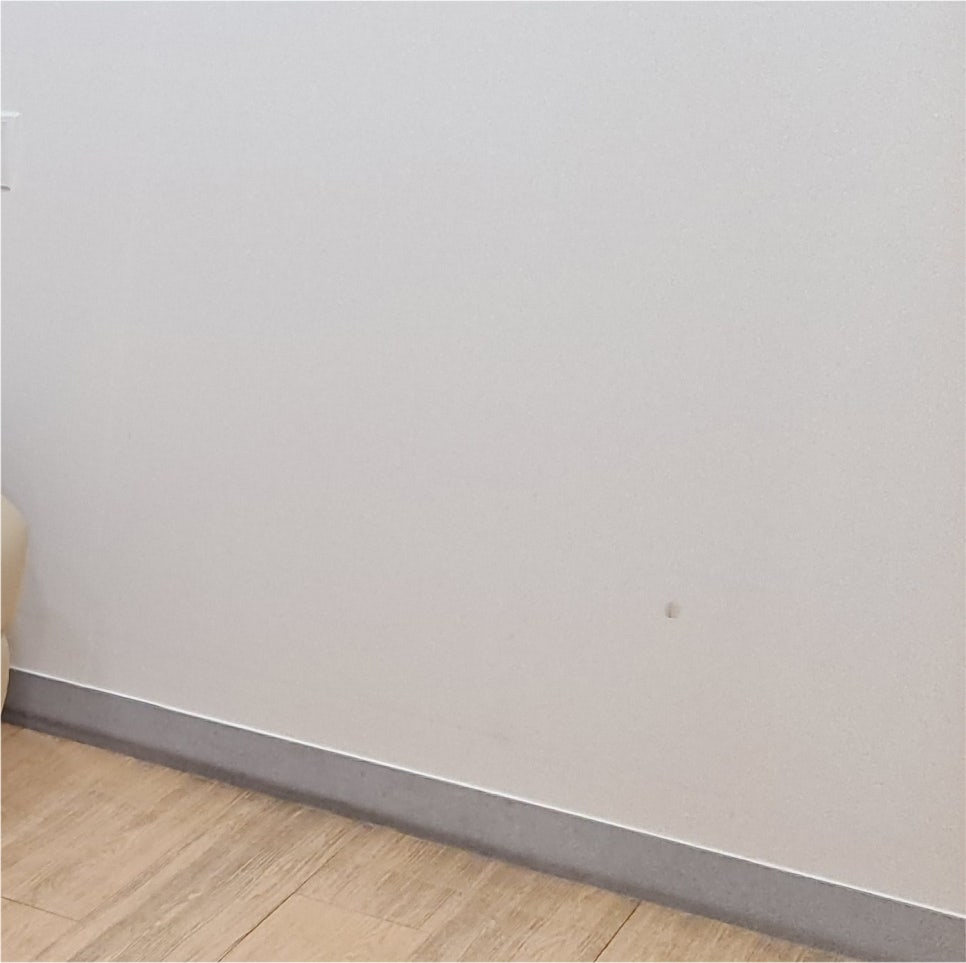 남자눈수술 느끼하지 않는 담백한 라인을 관련 이미지 20