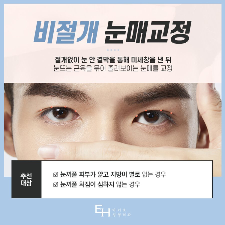 남자눈매교정전후 자연스러운 변화를 원한다면 관련 이미지 4