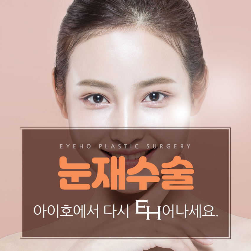 Double Eyelid Revision Surgery Cost: Check Everything Carefully, Including the Results image 1