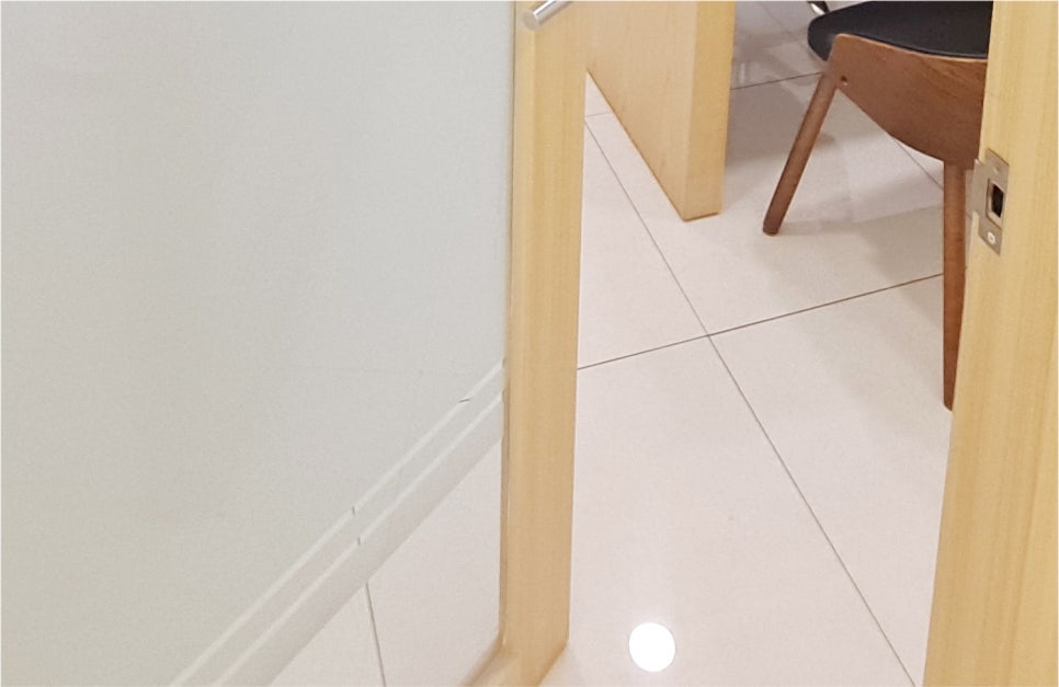 눈매교정 쌍수 : 무쌍 눈매교정 후기, 눈매교정 가격 비교 및 부작용 관련 이미지 23