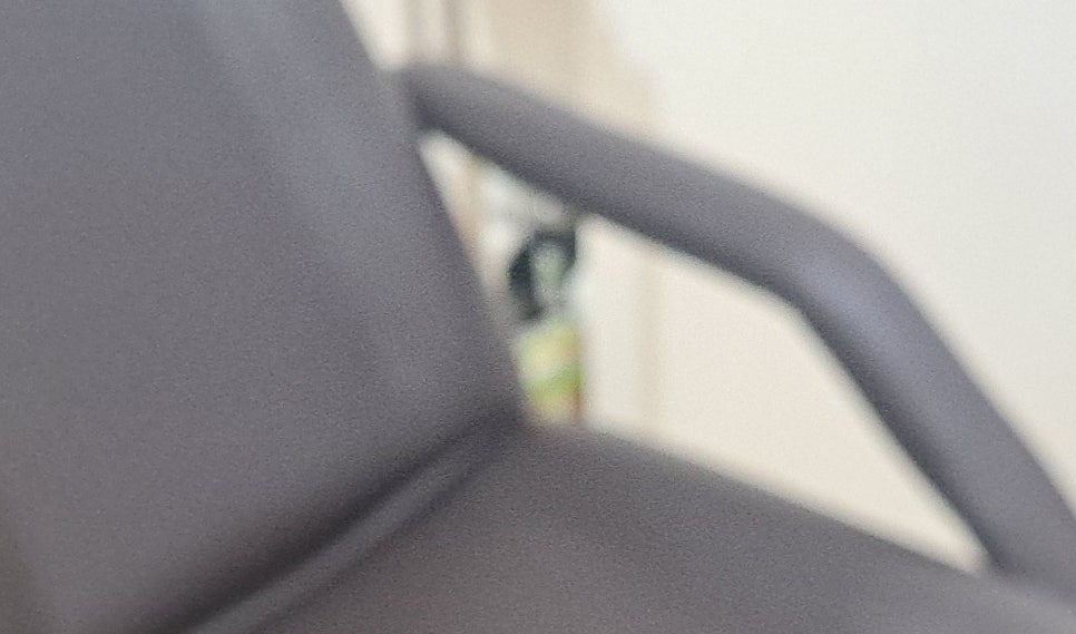 [눈성형종류] 눈찝기 풀어질 확률을 줄이고 싶다면 관련 이미지 19