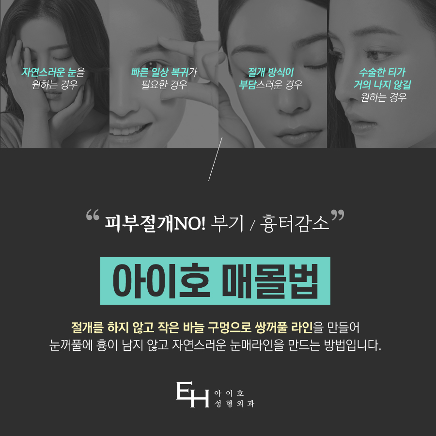 Famous Eye Plastic Surgery Clinic for Incisionless Double Eyelid Surgery, for an Attractive Eye Line image 3