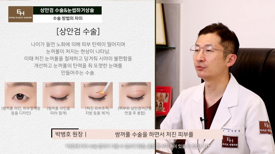 처진눈 상안검? 눈썹하거상술? 궁금하시다면 들어와!! 관련 이미지 17