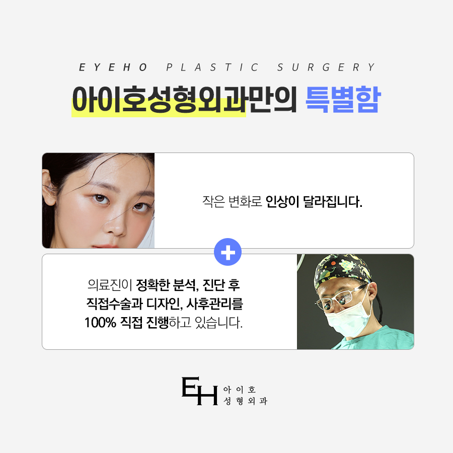 쌍꺼풀수술 가격 & 비절개 눈매교정 후기 (7일 경과) / 짝눈쌍수 관련 이미지 3