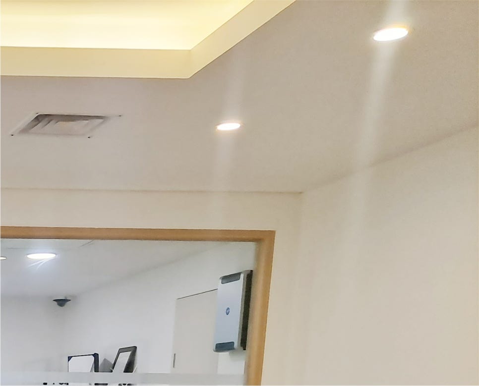 What to Consider for Satisfied Double Eyelid Burial Method Results image 15