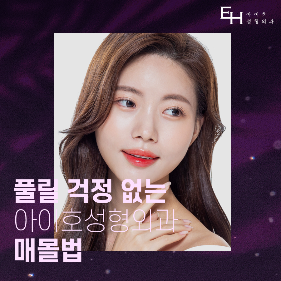 쌍수매몰법 매력적인 나만의 라인으로 관련 이미지 1