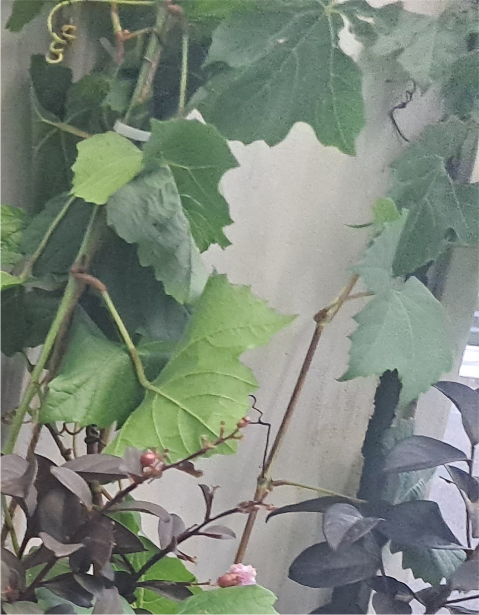 눈밑 하안검수술비용 동안으로 개선되기 위해서 관련 이미지 17