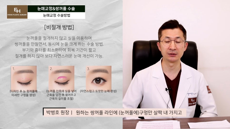 Double Eyelid Surgery and Ptosis Correction Must Be Done Together!? Here Is the Truth. image 18