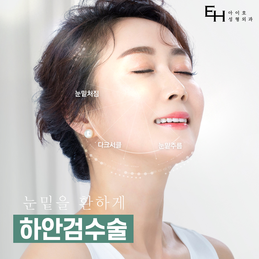 하안검수술 : 눈밑처짐수술 / 하안검 수술 후기, 비용, 회복기간, 부작용 관련 이미지 1