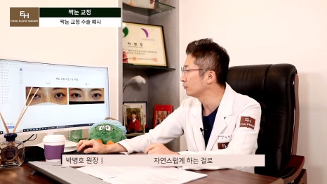 짝눈이 고민인데 양쪽 눈 수술하기 싫어요!! 한쪽 눈만 수술 가능!? 관련 이미지 14