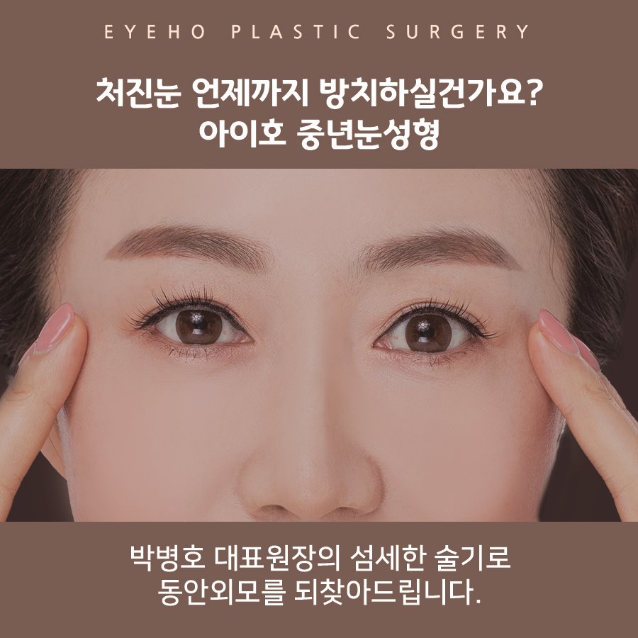 Brow Lift Review: Droopy Eye Surgery & Brow Lift Methods / Brow Lift Scars image 5