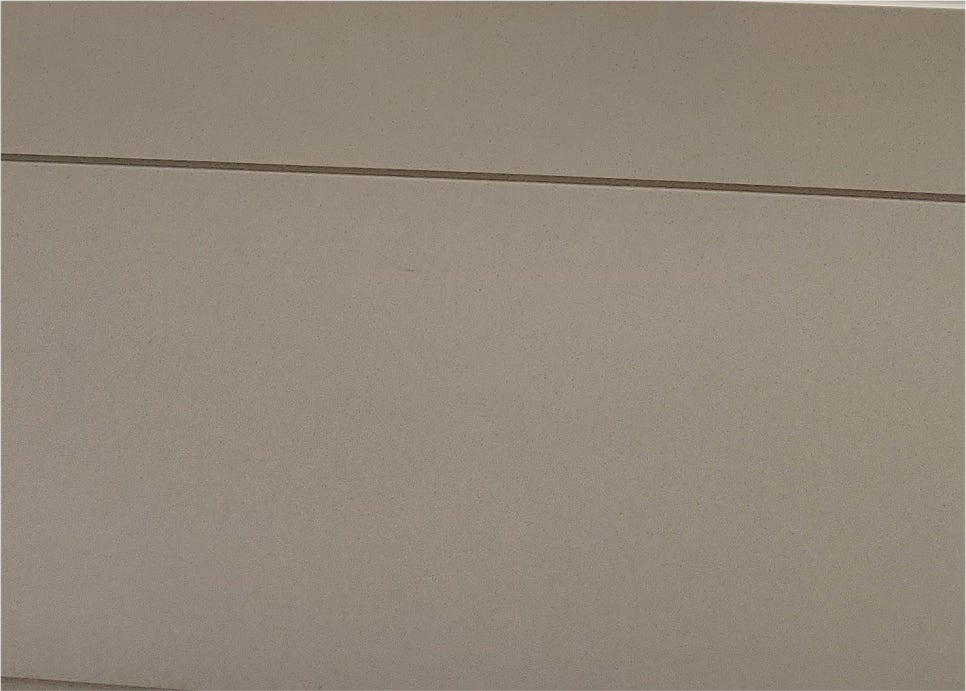 Brow Lift Review: Cost and Scar Comparison image 33