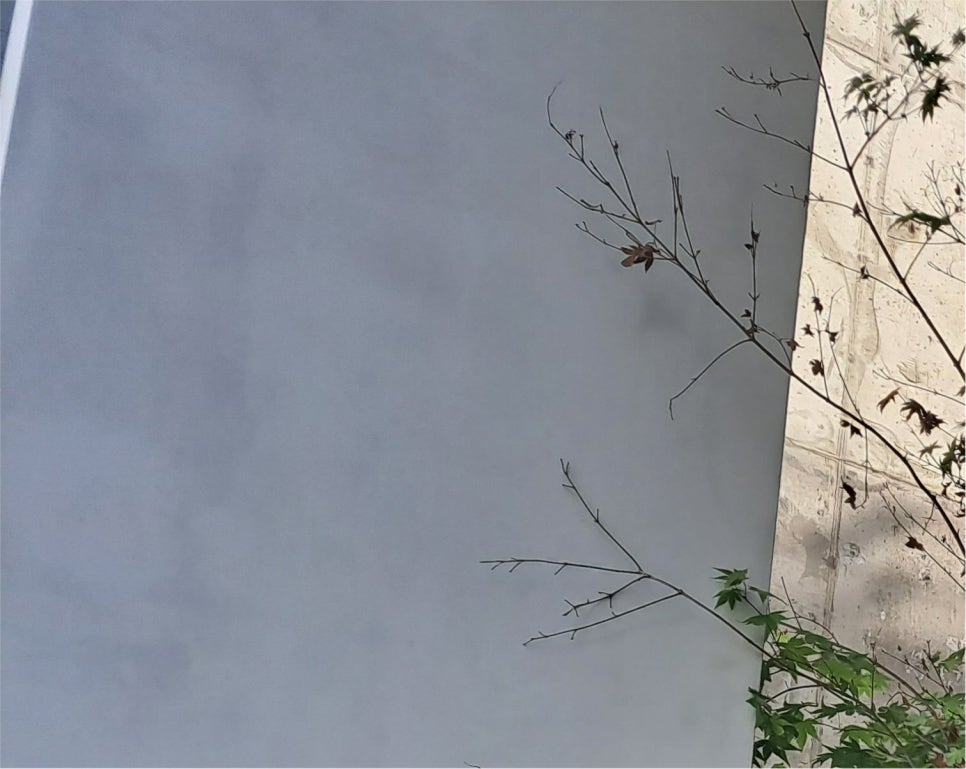 소세지눈 재수술 붓기 고민하지 않으려면 관련 이미지 14