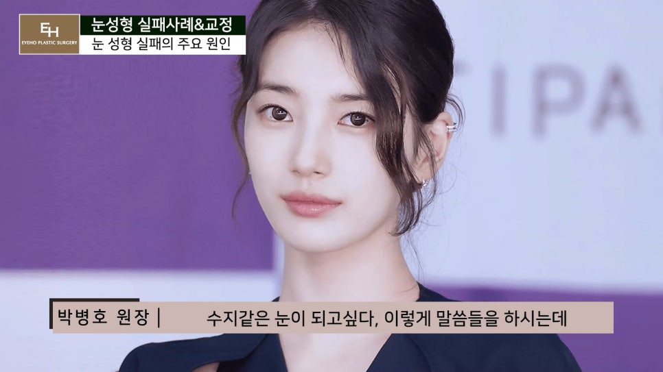 눈성형 실패하지 않고 성공하기 위해서는 관련 이미지 10
