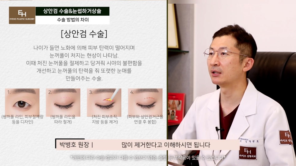 처진눈 상안검? 눈썹하거상술? 궁금하시다면 들어와!! 관련 이미지 18