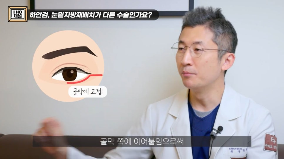 눈밑지방재배치 VS 하안검 수술 차이점은? 관련 이미지 14