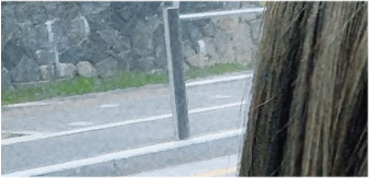 쌍수 눈재수술 비용 및 한쪽 재수술 / 짝눈 재수술 방법 공유 관련 이미지 23
