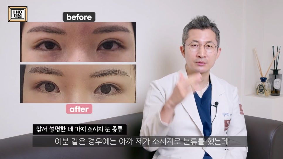소세지눈 다 같은 게 아니다!? 유형별 재수술 방법에 대해 알려드리겠습니다. 관련 이미지 50