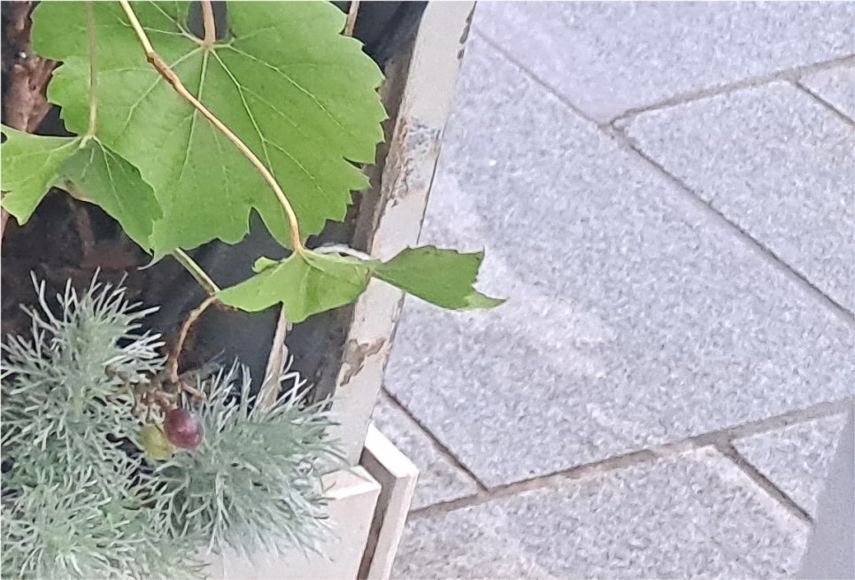 눈밑 하안검수술비용 동안으로 개선되기 위해서 관련 이미지 14