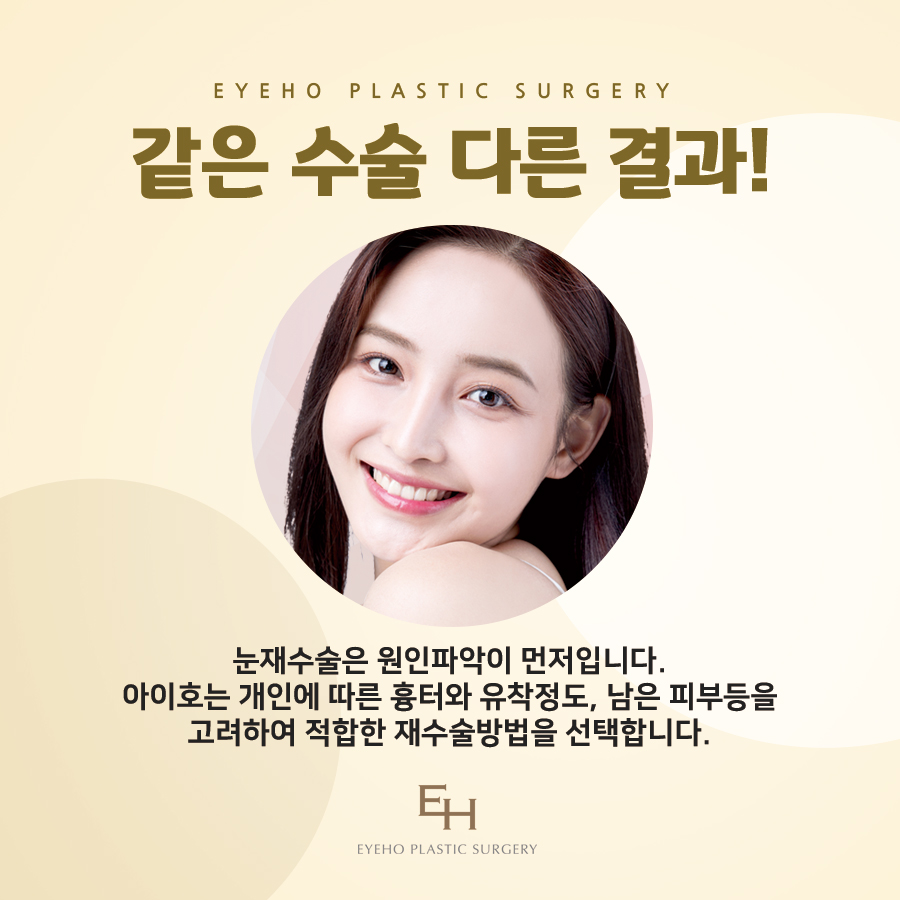 Double Eyelid Revision Surgery Review: Be Sure to Check Carefully. image 3