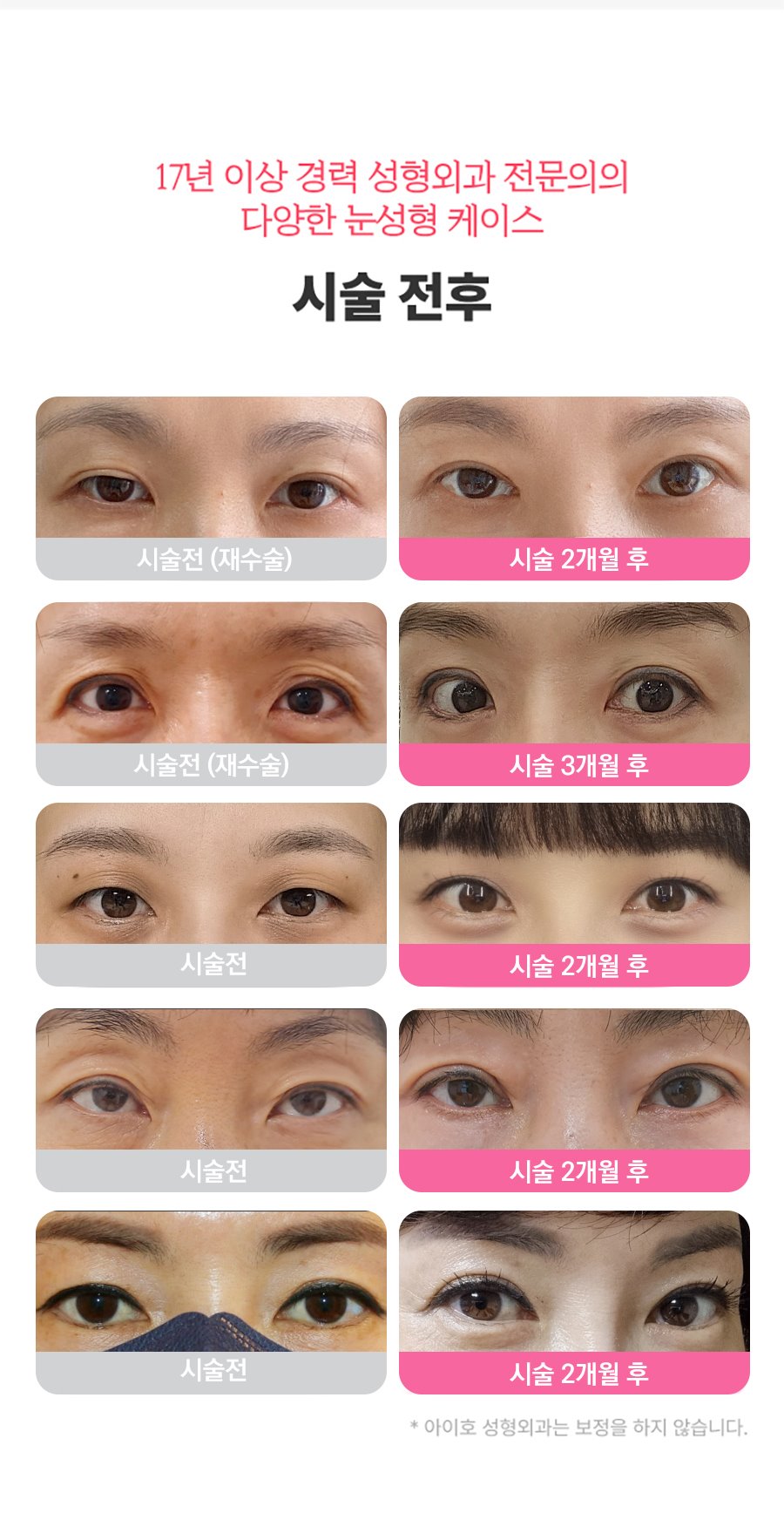 Eye Specialist Apgujeong Plastic Surgery eyeho — August 15 Liberation Day Closure Notice image 3