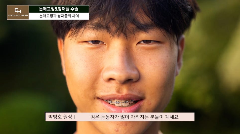 Double Eyelid Surgery and Ptosis Correction Must Be Done Together!? Here Is the Truth. image 10