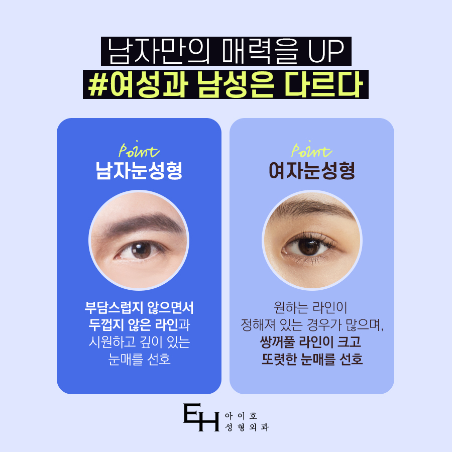 남자 눈매교정 가격 및 남자 눈매교정 전후 차이 비교 분석 관련 이미지 2