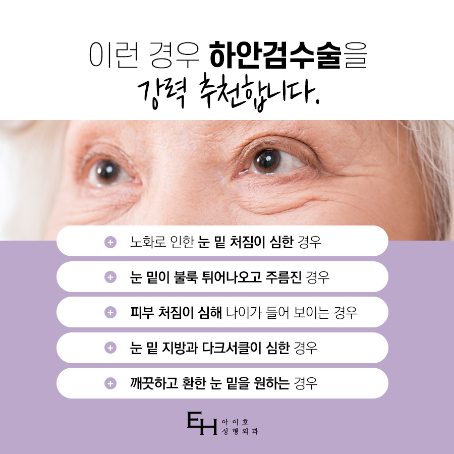 하안검수술 : 눈밑처짐수술 / 하안검 수술 후기, 비용, 회복기간, 부작용 관련 이미지 4