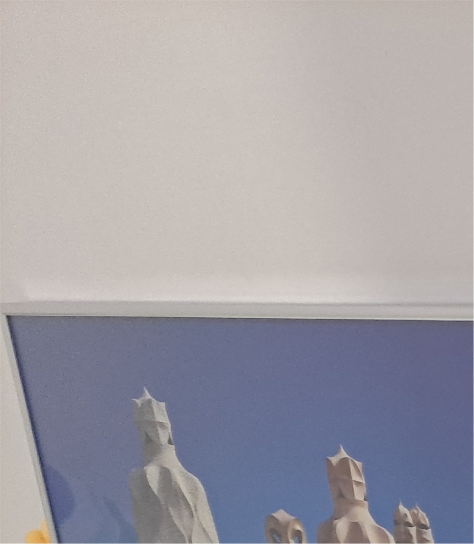 눈재수술후기 전체적인 조화를 위해 관련 이미지 15