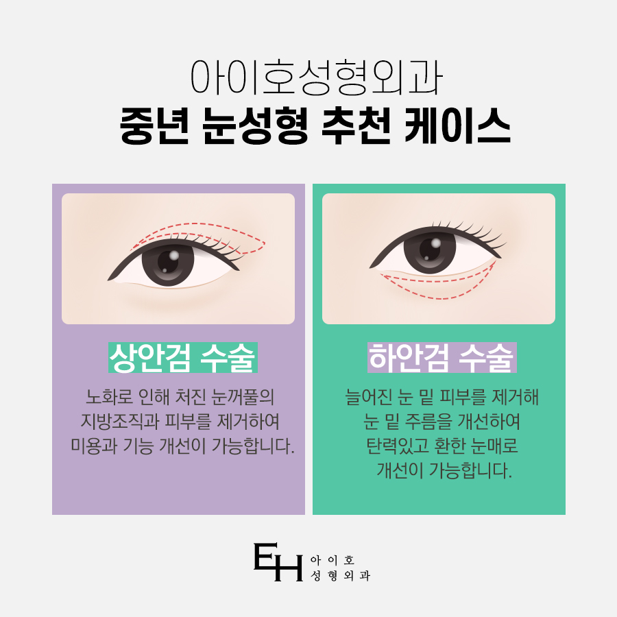 Comparison of the Differences in Reviews of Upper and Lower Eyelid Surgery image 4