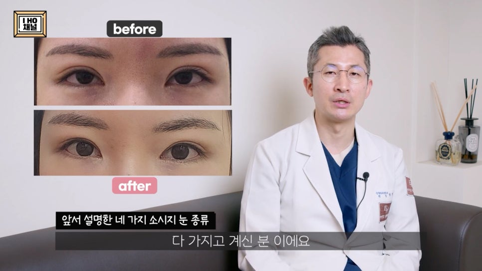 소세지눈 다 같은 게 아니다!? 유형별 재수술 방법에 대해 알려드리겠습니다. 관련 이미지 51